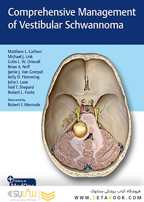 Comprehensive Management of Vestibular Schwannoma 1st Edition2019 مدیریت جامع شوانوم دهلیزی