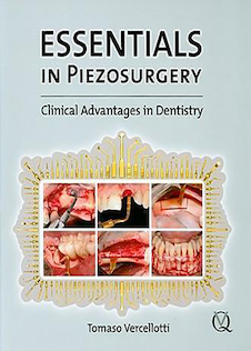 عکس Essentials in Piezosurgery, 1st Edition2009 موارد ضروری در جراحی پیزو