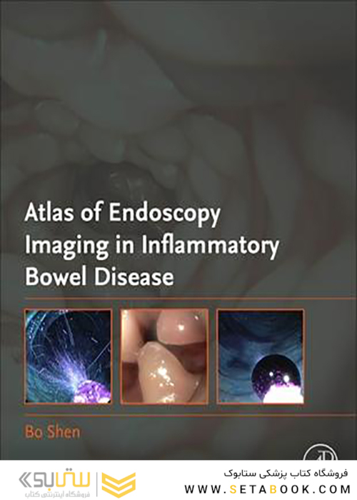 Atlas of Endoscopy Imaging in Inflammatory Bowel Disease2019 تصویربرداری اطلس از آندوسکوپی در بیماری التهابی روده