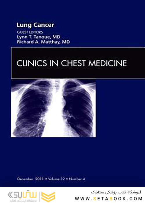 Lung Cancer (Volume 32-4), 1st Edition2011 سرطان ریه (جلد 32-4)
