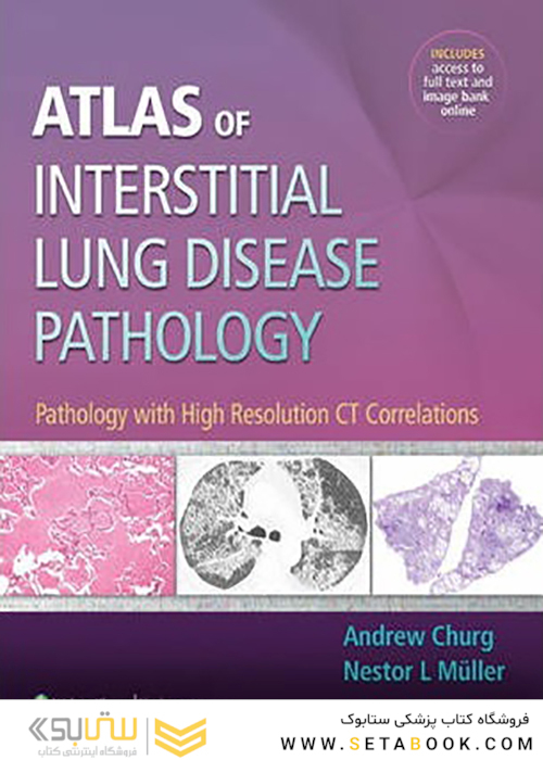 Atlas of Interstitial Lung Disease Pathology 2014