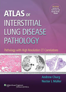 عکس Atlas of Interstitial Lung Disease Pathology 2014