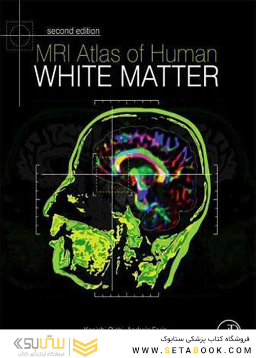 MRI Atlas of Human White Matter, 2nd Edition2010 اطلس ماده سفید انسان