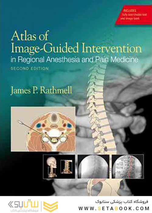 Atlas of Image-Guided Intervention in Regional Anesthesia and Pain Medicine, Second Edition2012 اطلس مداخله با راهنمای تصویر در بیهوشی منطقه ای و داروی درد