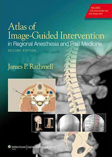 عکس Atlas of Image-Guided Intervention in Regional Anesthesia and Pain Medicine, Second Edition2012 اطلس مداخله با راهنمای تصویر در بیهوشی منطقه ای و داروی درد