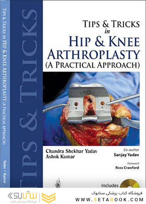 Tips and Tricks in Hip and Knee Arthroplasty2014 نکات و نکاتی در آرتروپلاستی مفصل ران و زانو
