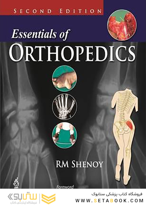 Essentials of Orthopedics, 2nd Edition2015 ملزومات ارتوپدی