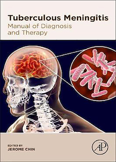 عکس Tuberculous-Meningitis2020 مننژیت سل