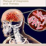 Tuberculous-Meningitis2020 مننژیت سل