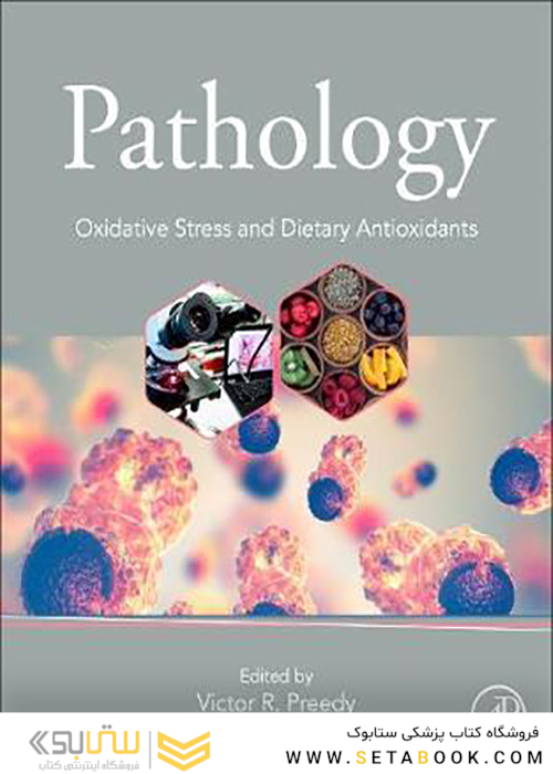 Pathology: Oxidative Stress and Dietary Antioxidants 2020