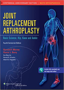 عکس Joint Replacement Arthroplasty, (Volume 2) Fourth2011 آرتروپلاستی جایگزینی مفصل: علوم پایه ، مفصل ران ، زانو و مچ پا