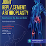 Joint Replacement Arthroplasty, (Volume 2) Fourth2011 آرتروپلاستی جایگزینی مفصل: علوم پایه ، مفصل ران ، زانو و مچ پا