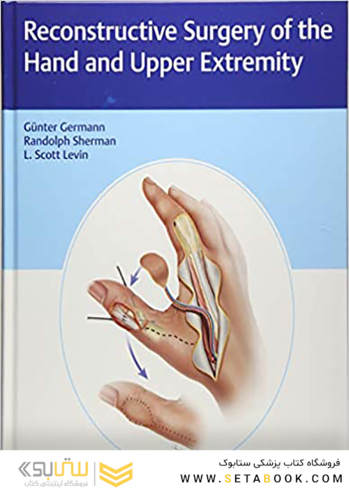 Reconstructive Surgery of the Hand and Upper Extremity2017 جراحی ترمیمی دست و اندام فوقانی