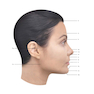 Dermal Fillers: Facial Anatomy and Injection Techniques2020