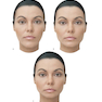 Dermal Fillers: Facial Anatomy and Injection Techniques2020
