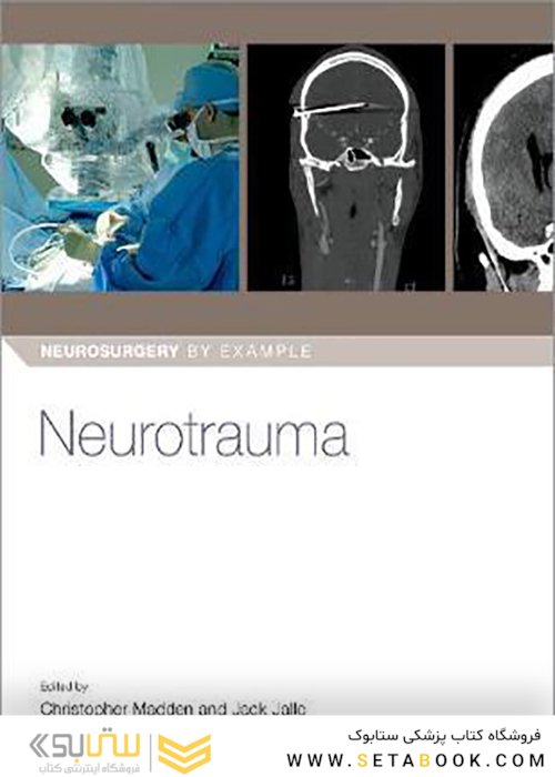 Neurotrauma-(Neurosurgery-by-Example)2020 جراحی مغز و اعصاب