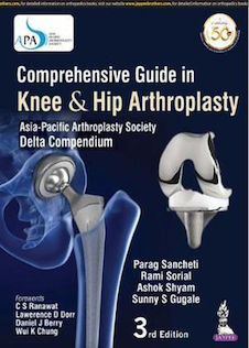 عکس Comprehensive Guide In Knee - Hip Arthroplasty