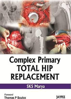 عکس Complex Primary Total Hip Replacement 1st Edition