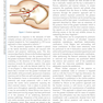 Complex Primary Total Hip Replacement 1st Edition