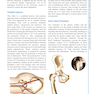 Complex Primary Total Hip Replacement 1st Edition