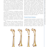 Complex Primary Total Hip Replacement 1st Edition