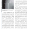 Complex Primary Total Hip Replacement 1st Edition