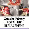 Complex Primary Total Hip Replacement 1st Edition