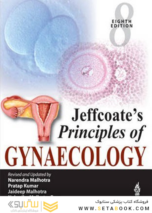 Jeffcoate