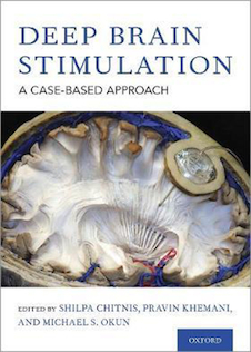 عکس Deep Brain Stimulation: A Case-based Approach 1st Edition