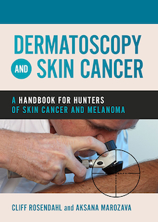 عکس Dermatoscopy and Skin Cancer : A handbook for hunters of skin cancer and melanoma 2019 درماتوسکوپی و سرطان پوست: کتاب راهنما سرطان پوست