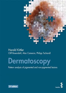 عکس Dermatoscopy: Pattern analysis of pigmented and non-pigmented lesions