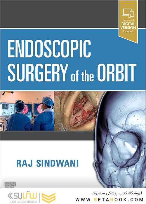 Endoscopic Surgery of the Orbit 1st Edition