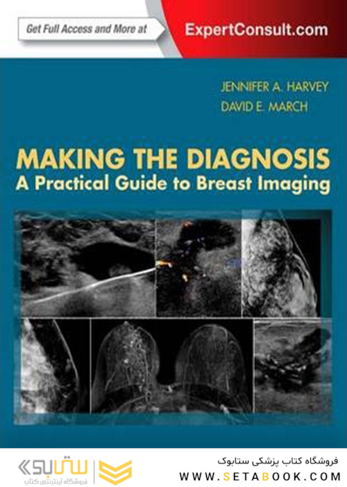 Making the Diagnosis: A Practical Guide to Breast Imaging: Expert Consult - Online and Print 1st Edition
