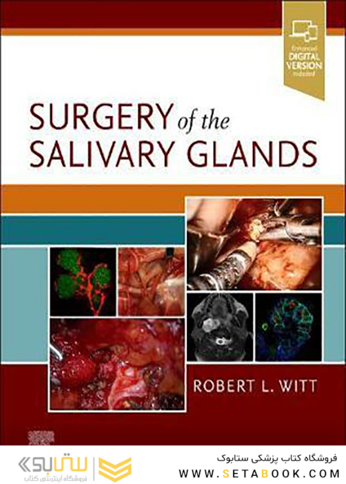Surgery of the Salivary Glands2020 جراحی غدد بزاقی