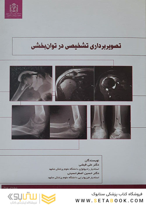 تصویربرداری تشخیصی در توان بخشی