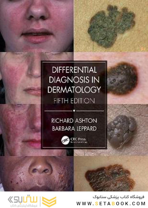 Differential Diagnosis in Dermatology, 5th Edition2021 تشخیص افتراقی در پوست