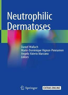 عکس Neutrophilic Dermatoses2018