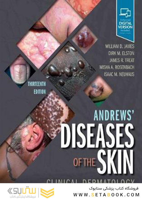 Andrews