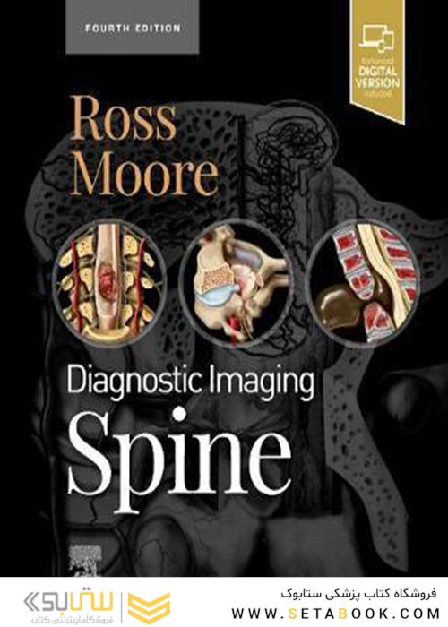 Diagnostic Imaging: Spine2021 تصویربرداری تشخیصی: ستون فقرات