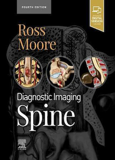 عکس Diagnostic Imaging: Spine2021 تصویربرداری تشخیصی: ستون فقرات