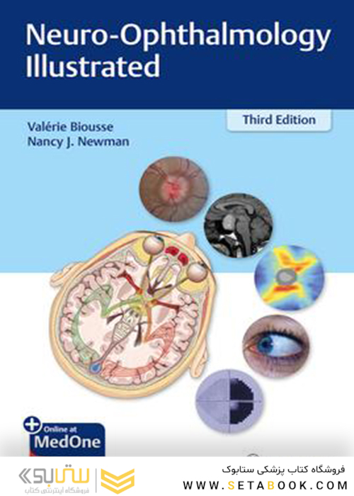Neuro-Ophthalmology Illustrated2020 چشم پزشکی مصور