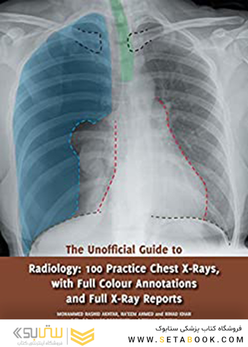 The Unofficial Guide to Radiology2017