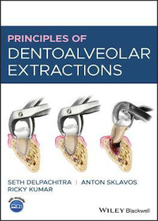 عکس Principles of Dentoalveolar Extractions2021 اصول استخراج دندان - آلوئولار