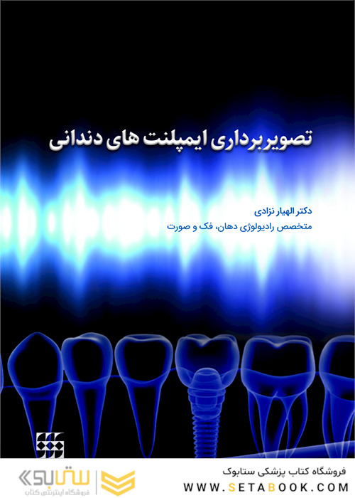 تصویربرداری ایمپلنت های دندانی