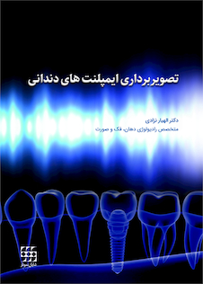 عکس تصویربرداری ایمپلنت های دندانی
