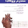 اصول پایه سندرم بروگادا