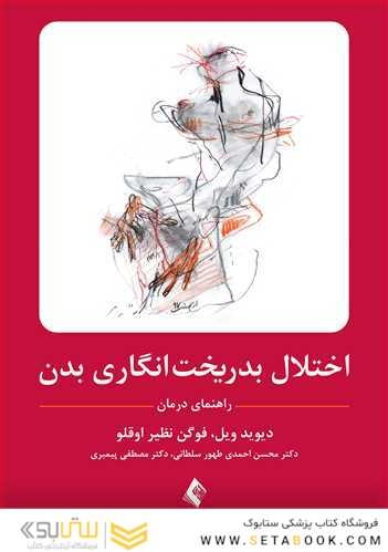 اختلال بدریخت انگاری بدن