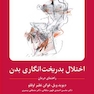 اختلال بدریخت انگاری بدن