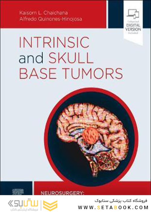 Intrinsic and Skull Base Tumors: Neurosurgery: Case Management Comparison Series2020