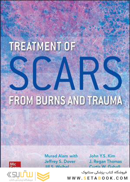 Treatment of Scars from Burns and Trauma2021درمان اسکار ناشی از سوختگی و تروما